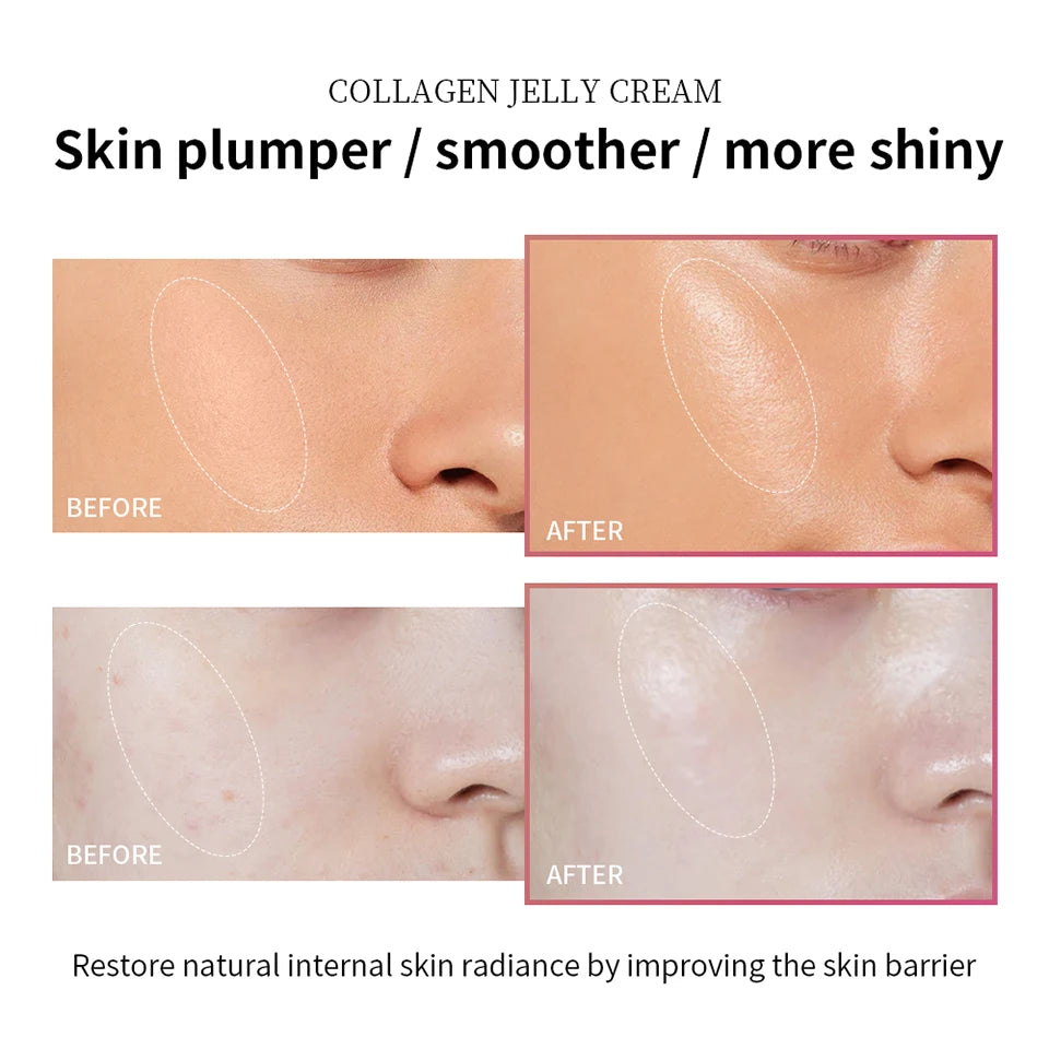 Collagen Jelly Cream
